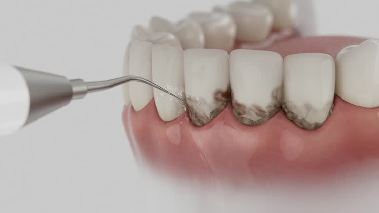 Trusted Dental Crowns And Bridges service in Walker, LA - Dentist Open Now